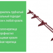 Снегозадержатели на крышу - Дачное строительство | Окна, балконы, лоджии